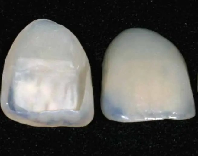 Two thin porcelain veneer shells on a dark background
