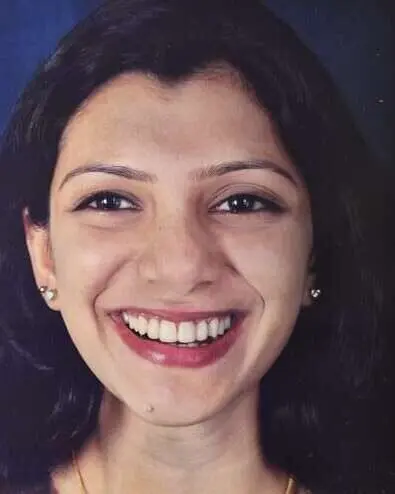 Gauri's smile after treatment