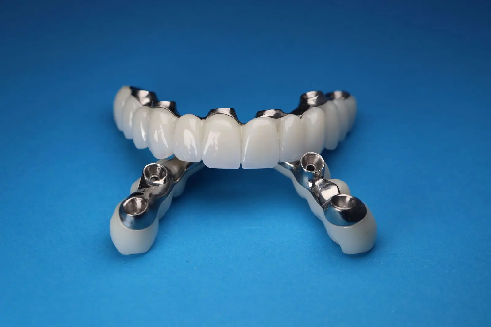 Full-arch implant-supported dental bridge on a blue background